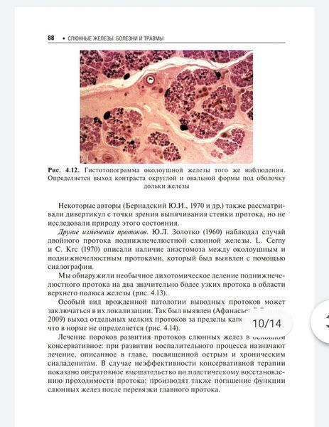 Слюнные железы. Болезни и травмы. Руководство. Афанасьев, NF0019920 фото