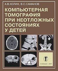 Холін А. В., Саманів В. С. Комп'ютерна томографія при невідкладних станах у дітей 11808 фото