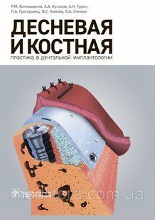 Бениашвили Р. М. та ін Яснева та кісткова пластика в дентальної імплантології 2017 рік 932 фото