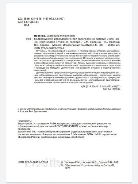 Ультразвукове дослідження при захворюваны артерій і вен нижніх кінцівок Носенко Дадова 88766666 фото