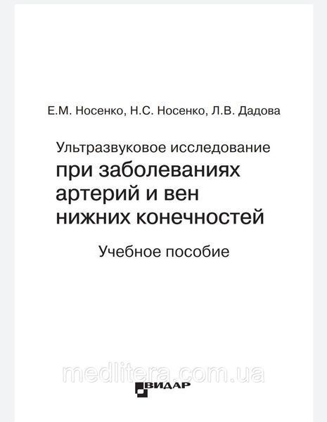 Ультразвукове дослідження при захворюваны артерій і вен нижніх кінцівок Носенко Дадова 88766666 фото
