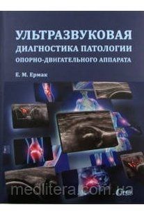 Єрмак Е. М. Ультразвукова діагностика патології опорно-рухового апарату. 765о фото