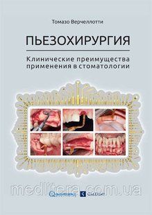 Верчеллотти Т. П'єзохірургія. Клінічні переваги застосування в стоматології. 90402535 фото