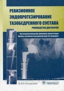 Джакофски Дж., Хедли Э.К. Ревизионное эндопротезирование тазобедренного сустава. Руководство для врачей. 566270939 фото