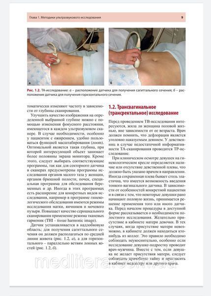 Руководство по ультразвуковой диагностике в акушерстве и гинекологии - Озерская И.А. 2021 год 76н4у фото