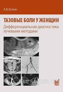 Холин А.В. Тазовые боли у женщин. Дифференциальная диагностика лучевыми методами 689328740 фото