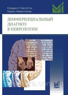 Диференціальний діагноз у неврології - Мументалер М. 12868 фото