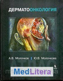 Молочков А. В. Дерматоонкология. Атлас 20121558 фото