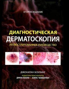Боулінг Діагностична дерматоскопія 2-ге видання Ілюстроване керівництво для дерматологів 98552200 фото
