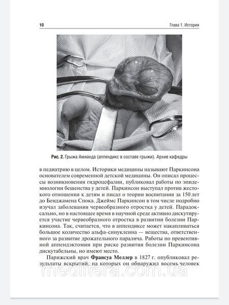 Морозов Д.А., Пименова Е.С. Острый аппендицит у детей 2022 год 76554333 фото