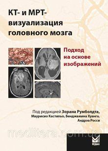 Румболдт, Кастільо, Хуанг КТ - і MPT - візуалізація головного мозку. Підхід на основі зображень 2016 рік 326566 фото