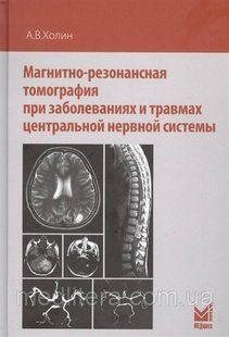 Холін Магнітно-резонансна томографія при захворюваннях і травмах центральної нервової системи 2-е вид 2019 рік 554471123 фото