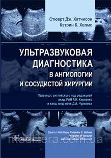 Хатчисон С. Д. Ультразвукова діагностика в ангіології та судинної хірургії 646599687 фото