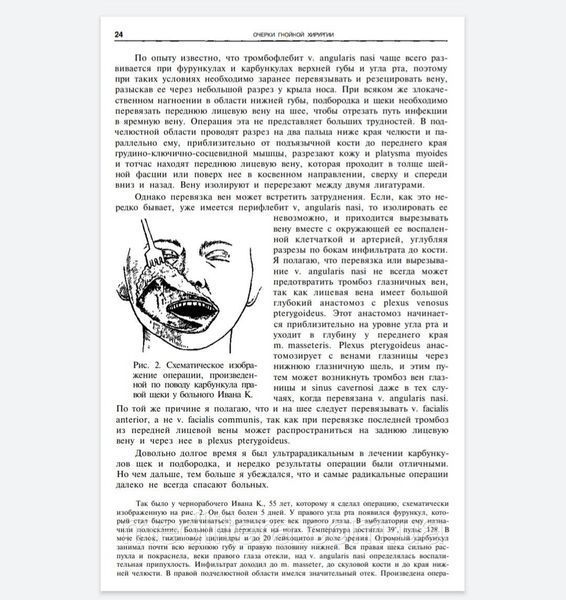 Войно-Ясенецкий В.Ф. Очерки гнойной хирургии 2020 год Учебник по хирургии 11574 фото