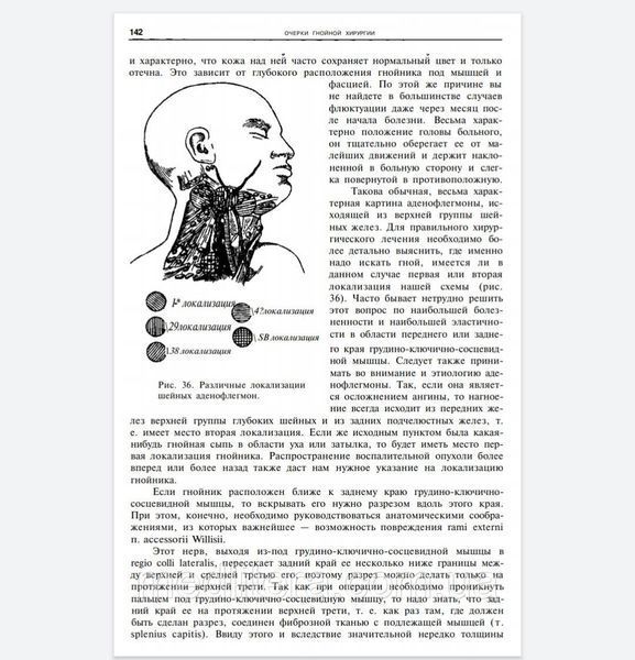 Войно-Ясенецкий В.Ф. Очерки гнойной хирургии 2020 год Учебник по хирургии 11574 фото