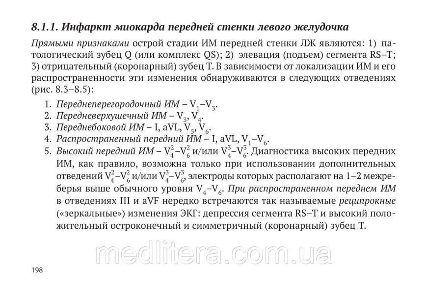 Электрокардиограмма: анализ и интерпретация - Струтынский А.В. 2022 г 12898 фото