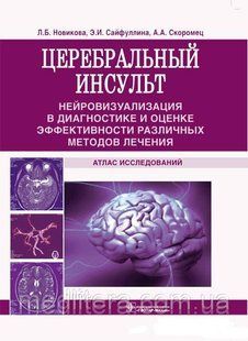 Новікова Л. Б., Сайфулліна Е. І., Скоромець А. А. Церебральний інсульт 11398 фото