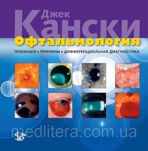 Канскі Дж. Офтальмологія: ознаки, причини, диференціальна діагностика 2012 рік 65443221 фото