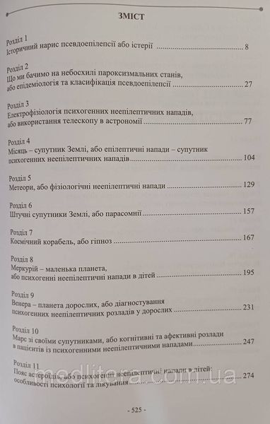 &Omicron;&Rho;ОС. У ПОШУКАХ НЕВІДОМОЇ ПЛАНЕТИ АБО ПСЕВДОЕПІЛЕПСІЯ головний біль фото