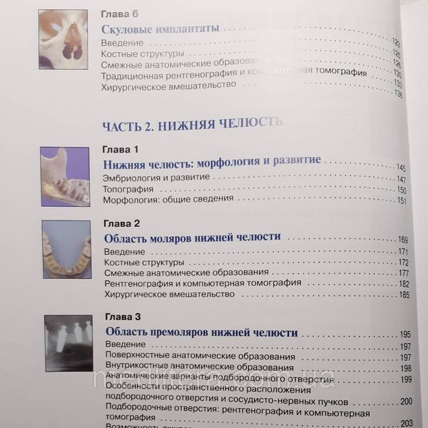Жан-Франсуа Годи Атлас анатомии зубочелюстной системы для имплантологов 906349925 фото
