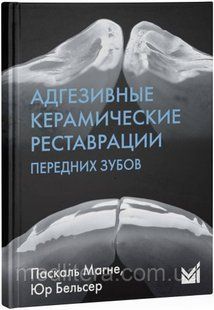 Адгезивні керамічні реставрації передніх зубів - Маньє П., Бельсер Ю. 12848 фото