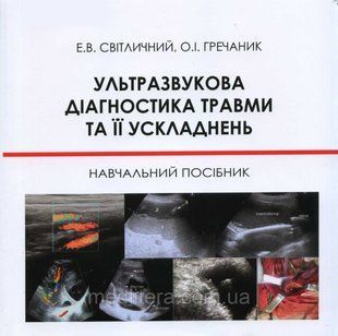 Світличний Е. В., Гречаник О. І. Ультразвукова діагностика травми та її ускладнень 510377100 фото