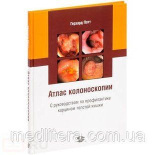 Потт Р. Атлас колоноскопії з керівництвом по профілактиці карцином товстої кишки 11552 фото