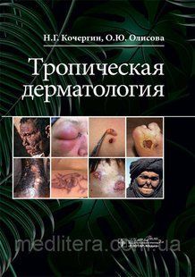 Тропічна дерматологія / Н. Р. Кочергін, О. Ю. Олисова. 2020 рік 12837 фото