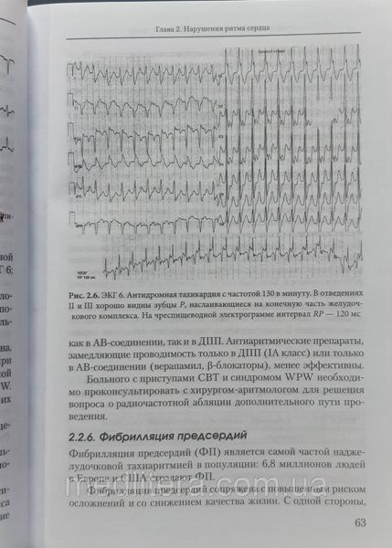 Сыркин А.Л. Дифференциальная диагностика болезней сердца 712335952 фото