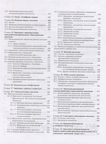 Карлів Ст. Епілепсія у дітей і дорослих жінок і чоловіків 2019 рік 4837387 фото