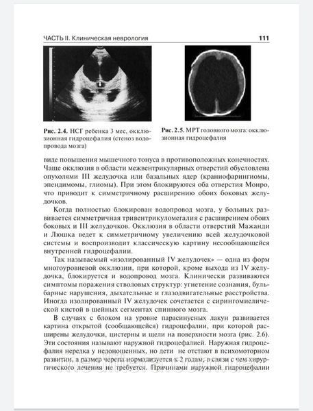 Петрухін А. С. Дитяча неврологія. Підручник у 2-х томах. 8 фото