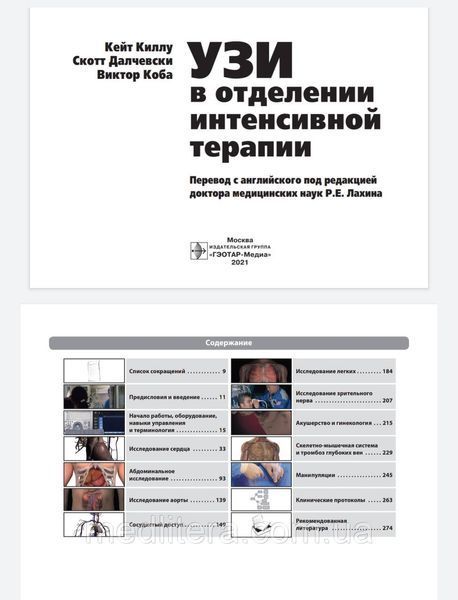 Киллу, Далчевски, Коба УЗИ в отделении интенсивной терапии 2021 год 77-2 фото