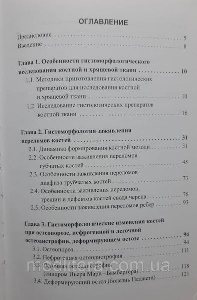 Осипенкова Т. К. Судово-медична експертиза кісток. Керівництво 865476882 фото