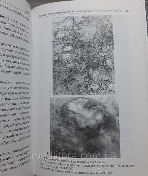 Осипенкова Т. К. Судово-медична експертиза кісток. Керівництво 865476882 фото