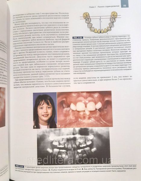 Проффіт Уільям Сучасна ортодонтія 2019 рік / Посібник з ортодонтії 3553 фото