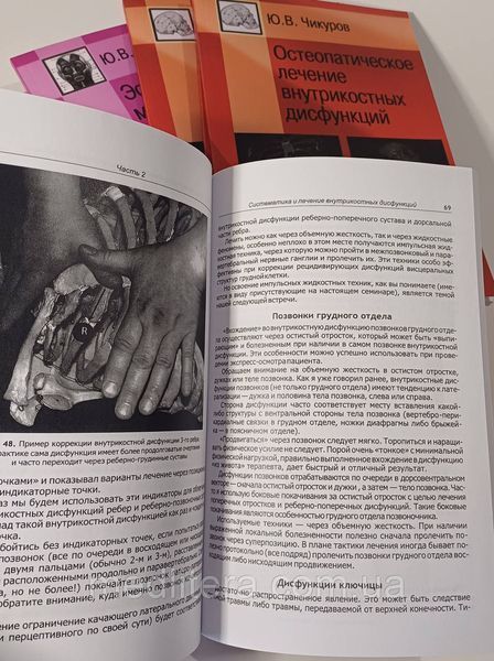 Чикуров Ю. В. Остеопатичне лікування внутрішньокісткових дисфункцій 11838 фото