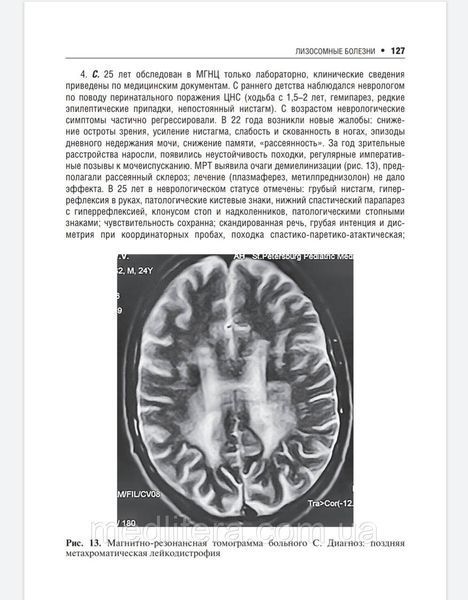 Руденская Наследственные нейрометаболические болезни юношеского и взрослого возраста. 2020 год 87653м фото
