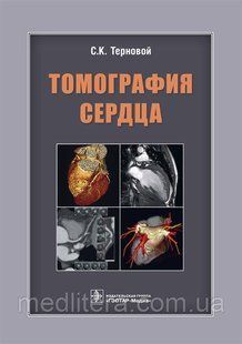 Терновий С. К. Томографія серця 2018 рік 999 фото