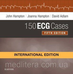 150 ECG Cases, International Edition,&nbsp;Hampton, John R 2019 год 988877777 фото
