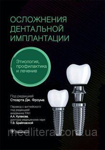 Дж. Фроум Ускладнення дентальної імплантації. Етіологія, профілактика і лікування 8755с фото