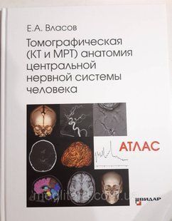 Власов Е. А. Томографічна КТ і МРТ анатомія центральної нервової системи людини Атлас 2020 рік 760 фото
