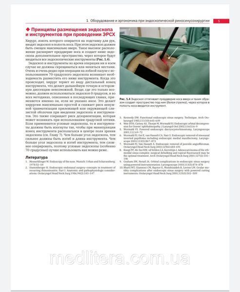 Волмард Ендоскопічна риносинусохірургія. Анатомія, об'ємна реконструкція та хірургічна техніка 2021 р 77 фото
