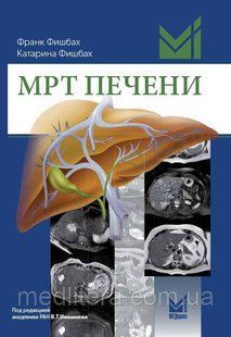 Фішбах Ф. МРТ ПЕЧІНКИ ДІАГНОСТИКА, ДИФЕРЕНЦІАЛЬНА ДІАГНОСТИКА, ПРИНЦИПИ ЛІКУВАННЯ Переклад з нім 2018 р. 566 фото