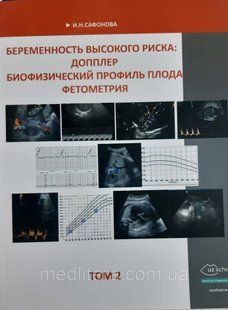 Сафонова. І. М. Вагітність високого ризику. Доплер. Біофізичний профіль плода. Фетометрія том 2. 1754408881 фото