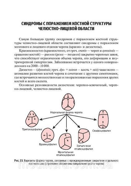 Врожденные пороки развития челюстно-лицевой области у детей : учебное пособие / под ред. О. З. Топольницкого NF0015412 фото