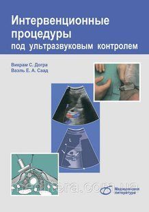Догра В. С. Інтервенційні процедури під ультразвуковим контролем 678113214 фото