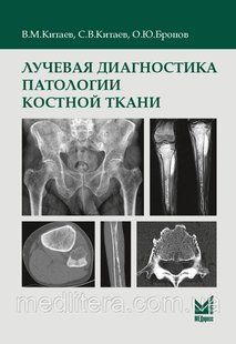 Китаев В.М. Лучевая диагностика патологии костной ткани 2022 года 8888 фото