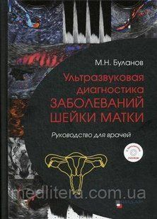 Буланов М. Н Ультразвукова діагностика захворювань шийки матки. Керівництво для лікарів + DVD 554414593 фото
