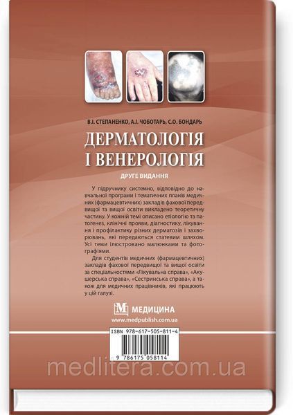 Дерматологія і венерологія: підручник / В.І. Степаненко, А.І. Чоботарь, С.О. Бондарь та ін. &mdash; 2-е видання 1671762982 фото