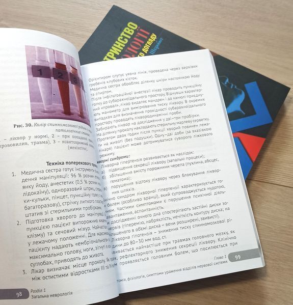 Шкробот. Медсестринство в неврології з основами сестринського догляду Тернопіль6 фото